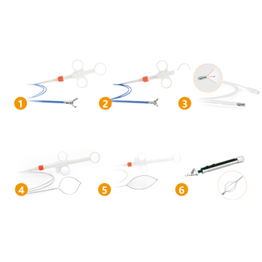 Forcep benda asing